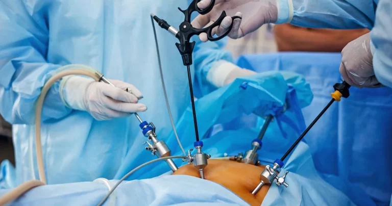 Laparoscopic Surgery: Making Surgery Less Invasive and More Efficient